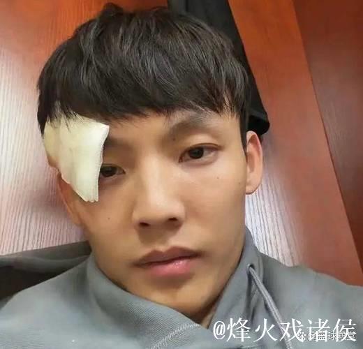 徐杰伤后返回基地视频曝光!左眼贴纱布无大碍! 徐杰伤后返回基地视频曝光!左眼贴纱布无大碍!